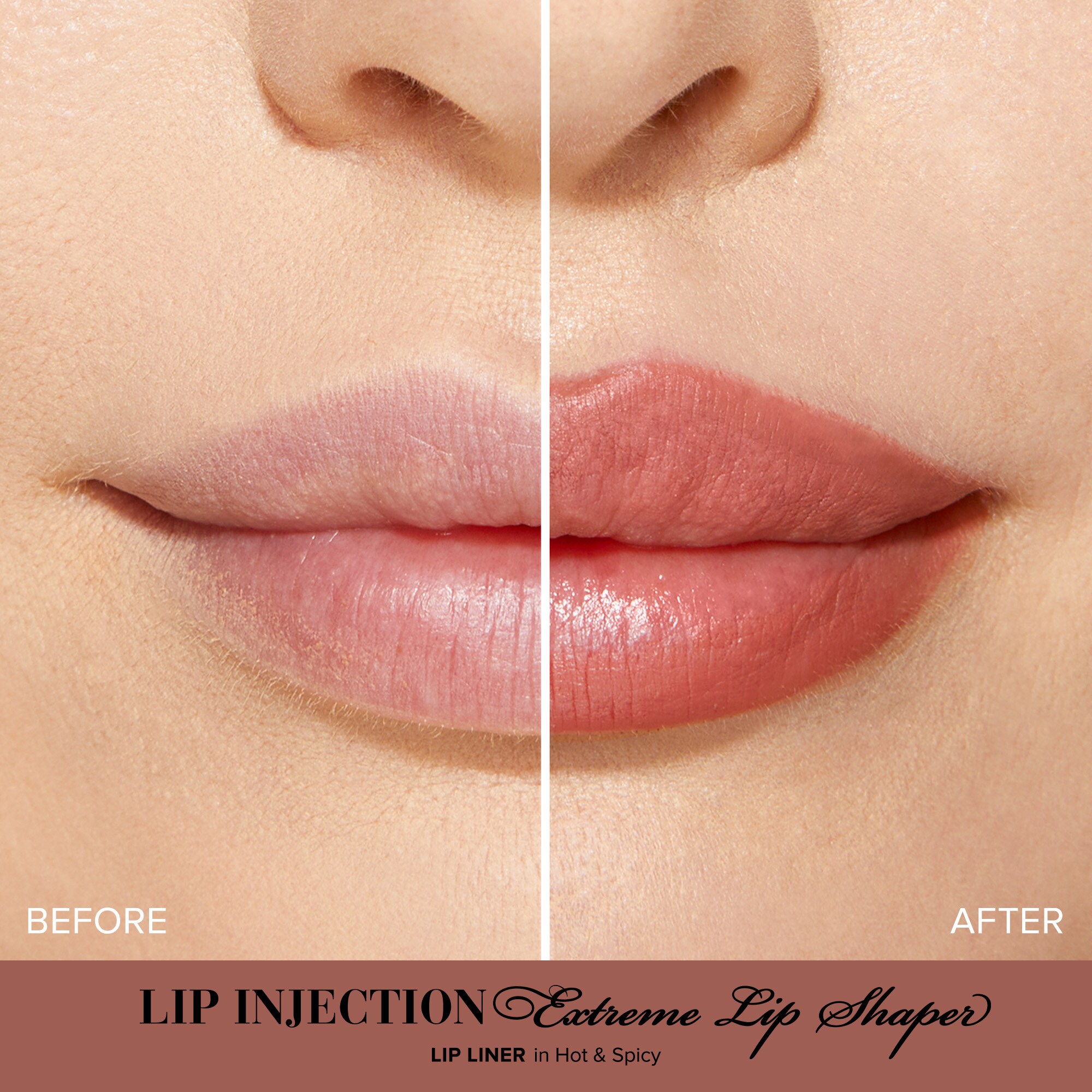 Lip Injection Extreme Lip Shaper