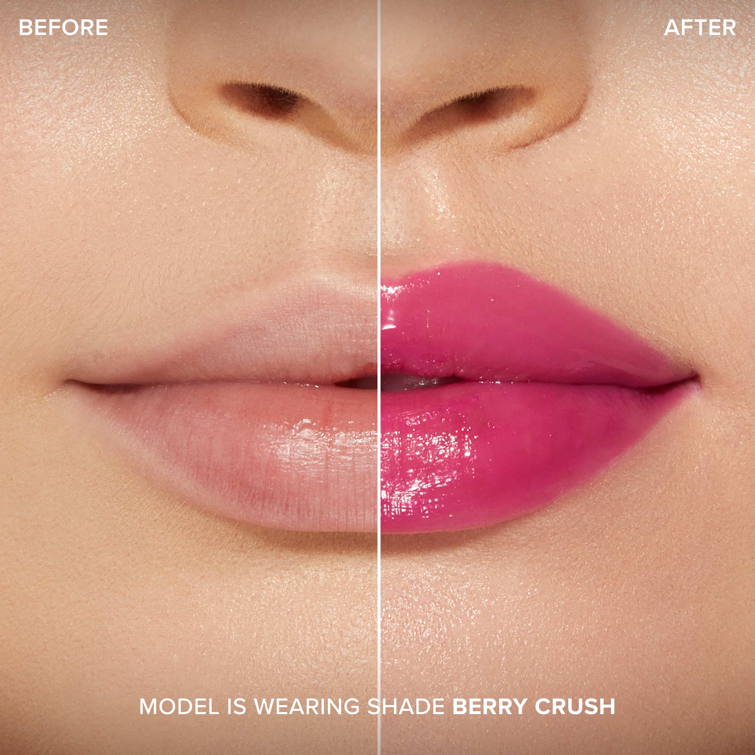 Lip Injection Maximum Plump