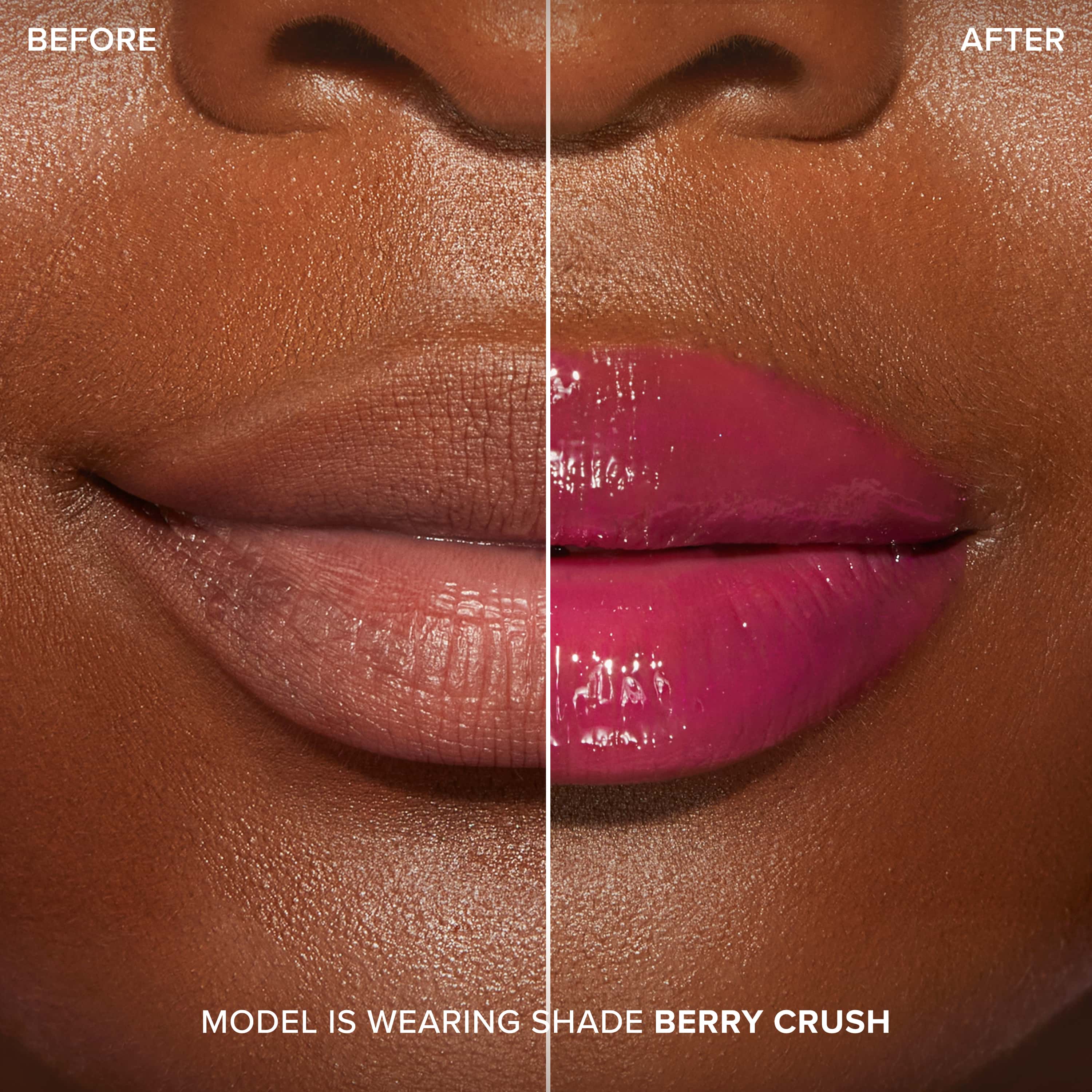 Lip Injection Maximum Plump